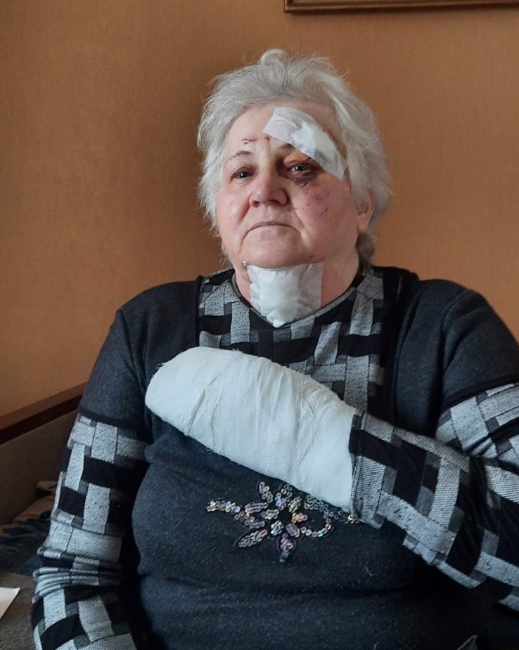 Так виглядала пані Зінаїда після обстрілу Чугуєва
